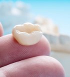 כתרים לשיניים: מה עדיף - חרסינה או זירקוניה?-תמונה
